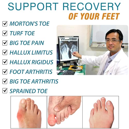 1 Pair Morton's Extension Orthotic,Carbon Fiber Insole,Rigid Foot Support Insert for Morton's Toe,Turf Toe,Hallux Rigidus,Arthritis 29.5cm(Men's Size 13/Women 14) - size: 29.5cm,Fit Women's Size 14, Men's 13